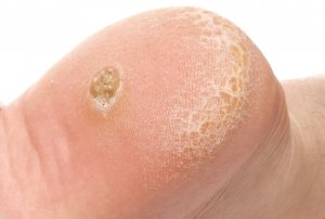 skin-problems-dermatology Dermatologist examining a foot
