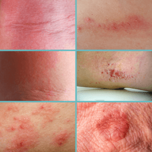 Totally Podiatry posts(10) Totally Podiatry posts(10)