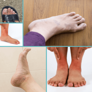 Totally Podiatry posts(11) Totally Podiatry posts(11)